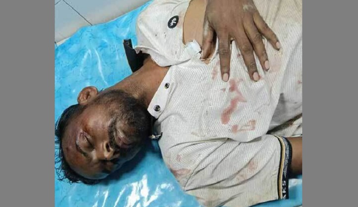 হিরো আলমের ওপর দুর্বৃত্তদের হামলা